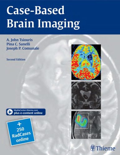 خرید و دانلود نسخه کامل کتاب Case-Based Brain Imaging_68bb4445edaa8.jpeg خرید و دانلود نسخه کامل کتاب Case-Based Brain Imaging