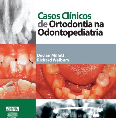 خرید و دانلود نسخه کامل کتاب Casos Clínicos de Ortodontia na Odontopediatria