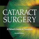 خرید و دانلود نسخه کامل کتاب Cataract Surgery: A Patient’s Guide to Treatment
