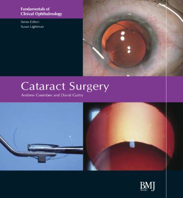 خرید و دانلود نسخه کامل کتاب Cataract Surgery: FCO Series