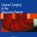 خرید و دانلود نسخه کامل کتاب Cataract Surgery in the Glaucoma Patient