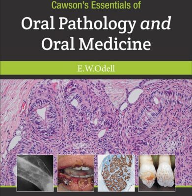 خرید و دانلود نسخه کامل کتاب Cawson’s Essentials of Oral Pathology and Oral Medicine