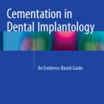 خرید و دانلود نسخه کامل کتاب Cementation in Dental Implantology: An Evidence-Based Guide