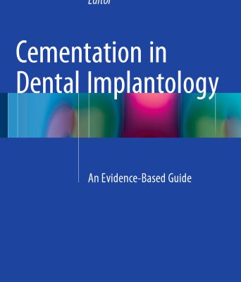 خرید و دانلود نسخه کامل کتاب Cementation in Dental Implantology: An Evidence-Based Guide