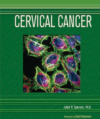 خرید و دانلود نسخه کامل کتاب Cervical Cancer (Deadly Diseases and Epidemics)