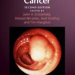 خرید و دانلود نسخه کامل کتاب Challenges in Colorectal Cancer