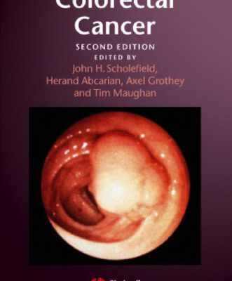 خرید و دانلود نسخه کامل کتاب Challenges in Colorectal Cancer