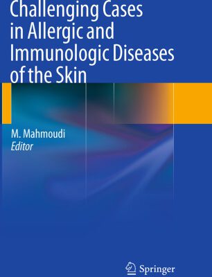خرید و دانلود نسخه کامل کتاب Challenging Cases in Allergic and Immunologic Diseases of the Skin