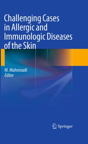 خرید و دانلود نسخه کامل کتاب Challenging Cases in Allergic and Immunologic Diseases of the Skin_68b99f8d72901.jpeg خرید و دانلود نسخه کامل کتاب Challenging Cases in Allergic and Immunologic Diseases of the Skin