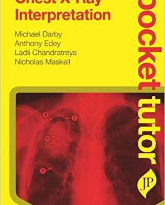 خرید و دانلود نسخه کامل کتاب Chest X-Ray Interpretation (Pocket Tutor)