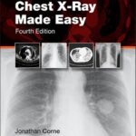 خرید و دانلود نسخه کامل کتاب Chest X-Ray Made Easy, 4th Edition (TRUE PDF)