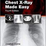خرید و دانلود نسخه کامل کتاب Chest X-Ray Made Easy (4th Edition)