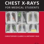 خرید و دانلود نسخه کامل کتاب Chest X-rays for Medical Students
