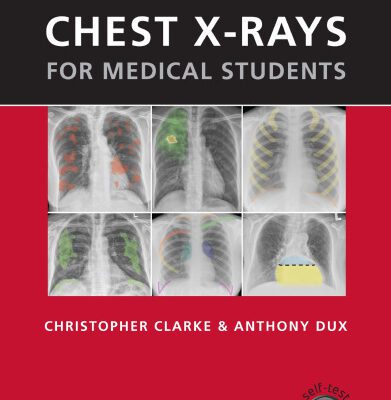 خرید و دانلود نسخه کامل کتاب Chest X-rays for Medical Students