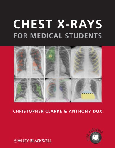 خرید و دانلود نسخه کامل کتاب Chest X-rays for Medical Students_68bb1deae8444.jpeg خرید و دانلود نسخه کامل کتاب Chest X-rays for Medical Students