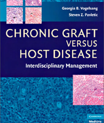 خرید و دانلود نسخه کامل کتاب Chronic Graft Versus Host Disease: Interdisciplinary Management