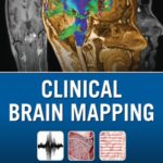 خرید و دانلود نسخه کامل کتاب Clinical Brain Mapping