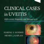 خرید و دانلود نسخه کامل کتاب Clinical Cases in Uveitis: Differential Diagnosis and Management