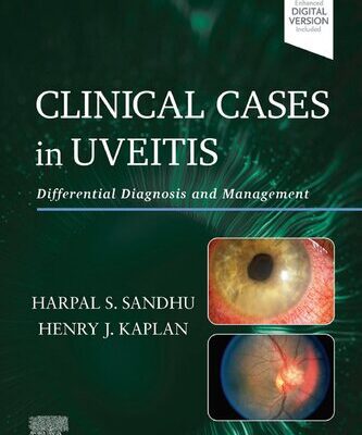 خرید و دانلود نسخه کامل کتاب Clinical Cases in Uveitis: Differential Diagnosis and Management