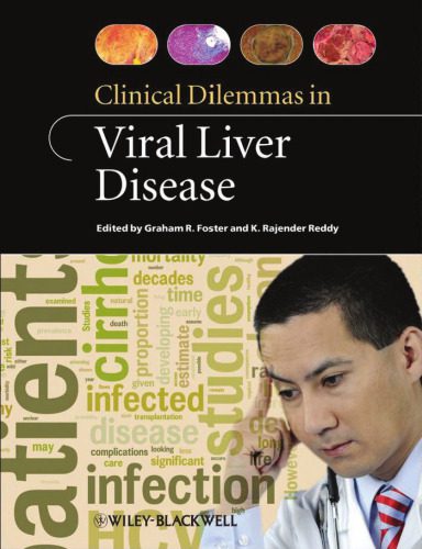 خرید و دانلود نسخه کامل کتاب Clinical Dilemmas in Viral Liver Disease_68b99a1705433.jpeg خرید و دانلود نسخه کامل کتاب Clinical Dilemmas in Viral Liver Disease