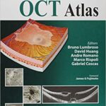 خرید و دانلود نسخه کامل کتاب Clinical En Face OCT Atlas