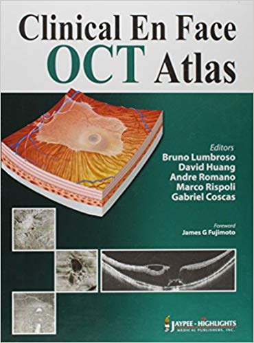 خرید و دانلود نسخه کامل کتاب Clinical En Face OCT Atlas_68ba2a572d911.jpeg خرید و دانلود نسخه کامل کتاب Clinical En Face OCT Atlas