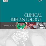 خرید و دانلود نسخه کامل کتاب Clinical Implantology By Ajay Vikram Singh – Original PDF