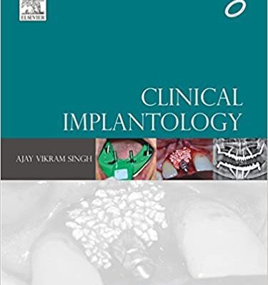 خرید و دانلود نسخه کامل کتاب Clinical Implantology By Ajay Vikram Singh – Original PDF