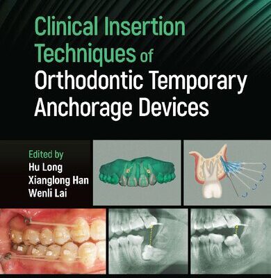 خرید و دانلود نسخه کامل کتاب Clinical Insertion Techniques of Orthodontic Temporary Anchorage Devices