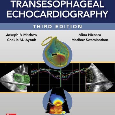 خرید و دانلود نسخه کامل کتاب Clinical Manual and Review of Transesophageal Echocardiography