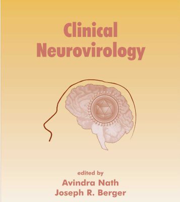 خرید و دانلود نسخه کامل کتاب Clinical Neurovirology
