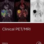 خرید و دانلود نسخه کامل کتاب Clinical PET / MRI – Radiology Molecular Imaging