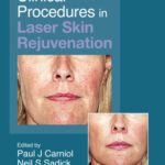 خرید و دانلود نسخه کامل کتاب Clinical Procedures in Laser Skin Rejuvenation (Series in Cosmetic and Laser Therapy)