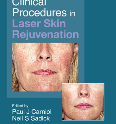 خرید و دانلود نسخه کامل کتاب Clinical Procedures in Laser Skin Rejuvenation (Series in Cosmetic and Laser Therapy)