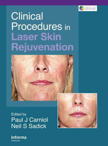 خرید و دانلود نسخه کامل کتاب Clinical Procedures in Laser Skin Rejuvenation (Series in Cosmetic and Laser Therapy)_68beb7e26e4d5.jpeg خرید و دانلود نسخه کامل کتاب Clinical Procedures in Laser Skin Rejuvenation (Series in Cosmetic and Laser Therapy)