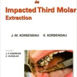 خرید و دانلود نسخه کامل کتاب Clinical Success In Impacted Third Molar Extraction
