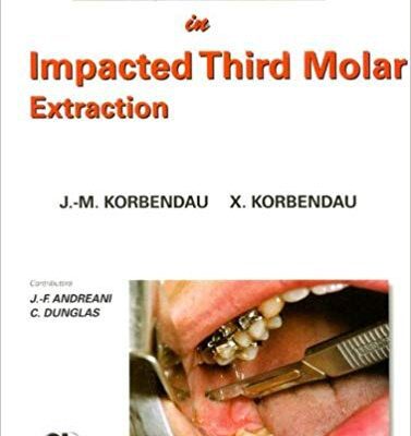 خرید و دانلود نسخه کامل کتاب Clinical Success In Impacted Third Molar Extraction