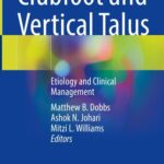 خرید و دانلود نسخه کامل کتاب Clubfoot and Vertical Talus : Etiology and Clinical Management