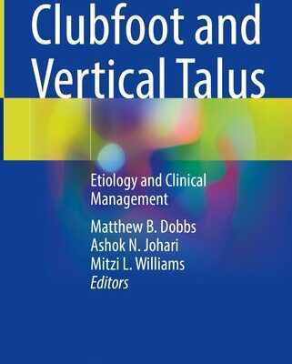 خرید و دانلود نسخه کامل کتاب Clubfoot and Vertical Talus : Etiology and Clinical Management