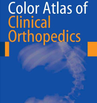 خرید و دانلود نسخه کامل کتاب Color Atlas of Clinical Orthopedics