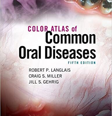 خرید و دانلود نسخه کامل کتاب Color Atlas of Common Oral Diseases (5th Edition) – Pdf