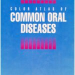 خرید و دانلود نسخه کامل کتاب Color Atlas of Common Oral Diseases