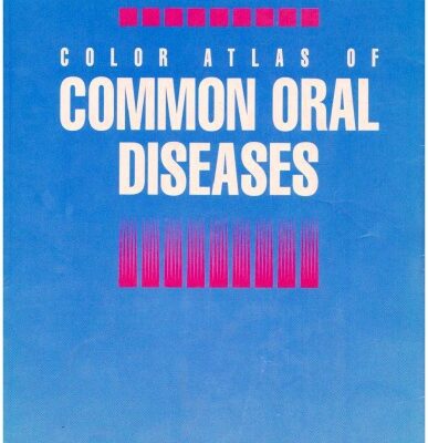 خرید و دانلود نسخه کامل کتاب Color Atlas of Common Oral Diseases