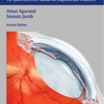 خرید و دانلود نسخه کامل کتاب Color Atlas of Ophthalmology: The Quick-Reference Manual for Diagnosis and Treatment