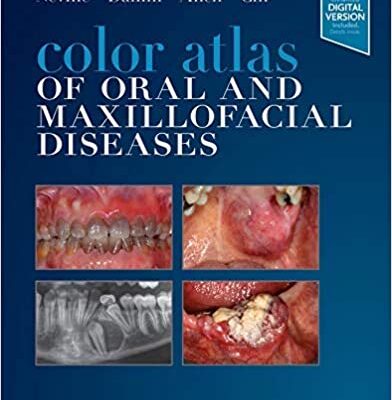 خرید و دانلود نسخه کامل کتاب Color Atlas of Oral and Maxillofacial Diseases – Original PDF