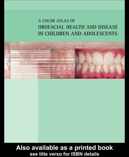خرید و دانلود نسخه کامل کتاب Color Atlas of Orofacial Health and Disease in Children and Adolescents_68b99fb797954.jpeg خرید و دانلود نسخه کامل کتاب Color Atlas of Orofacial Health and Disease in Children and Adolescents
