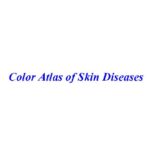 خرید و دانلود نسخه کامل کتاب Color Atlas of Skin Diseases
