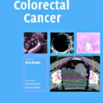 خرید و دانلود نسخه کامل کتاب Colorectal Cancer (Contemporary Issues in Cancer Imaging)