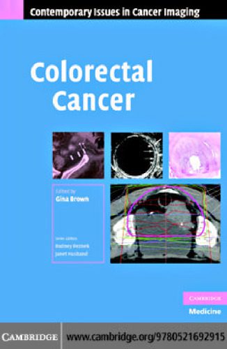 خرید و دانلود نسخه کامل کتاب Colorectal Cancer (Contemporary Issues in Cancer Imaging)_68bb2c8a6c5da.jpeg خرید و دانلود نسخه کامل کتاب Colorectal Cancer (Contemporary Issues in Cancer Imaging)
