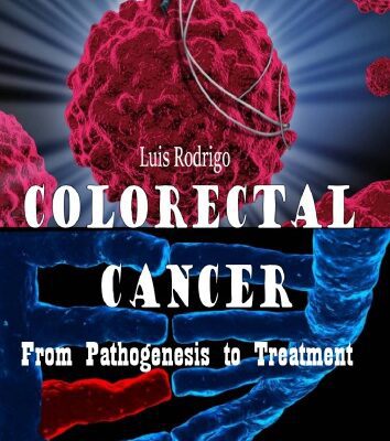 خرید و دانلود نسخه کامل کتاب Colorectal Cancer From Pathogenesis to Treatment